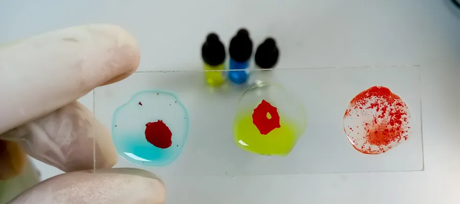 Serology and Laboratory Techniques